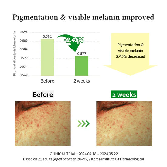 Dr.Althea Gentle Vitamin C Serum
